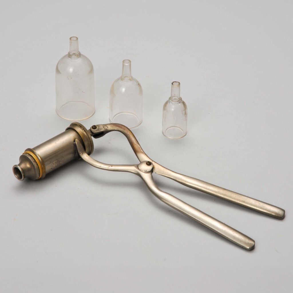 美顔術用カップス 関根久子氏（埼玉）寄贈